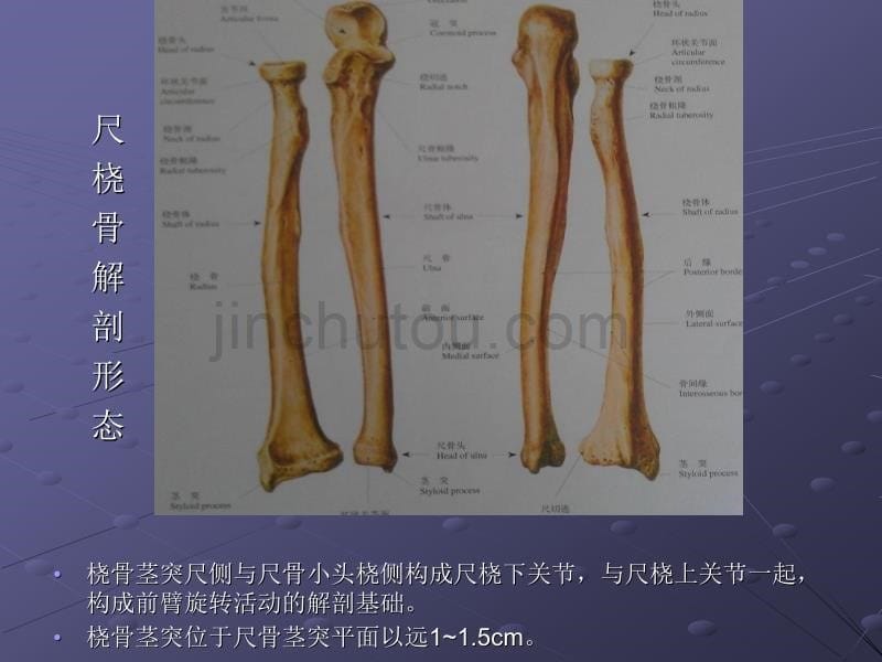 桡骨下段骨折_第5页