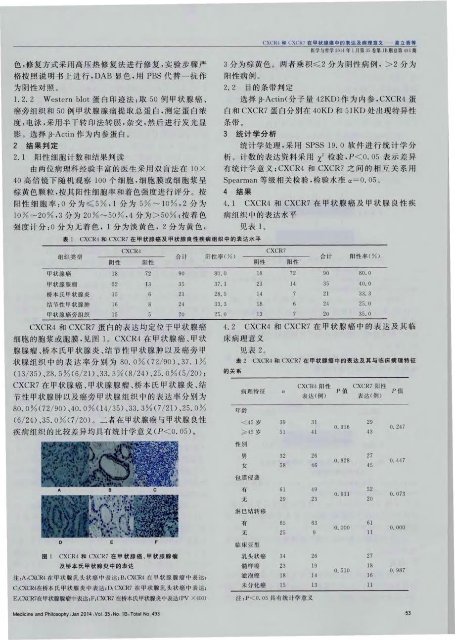 CXCR4和CXCR7在甲状腺癌中的表达及病理意义_第2页