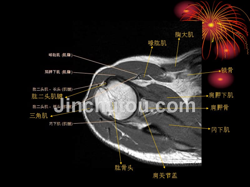 肩关节MRI解剖_第4页