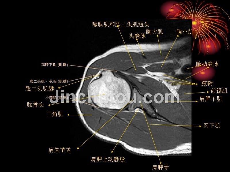 肩关节MRI解剖_第5页