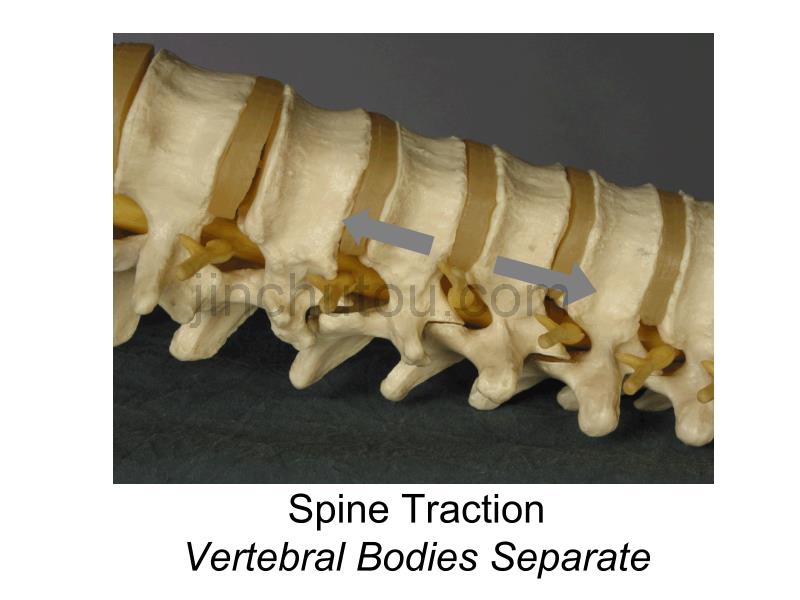 脊柱关节松动术_第2页