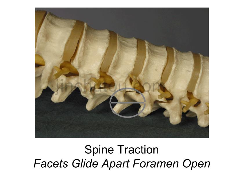 脊柱关节松动术_第4页