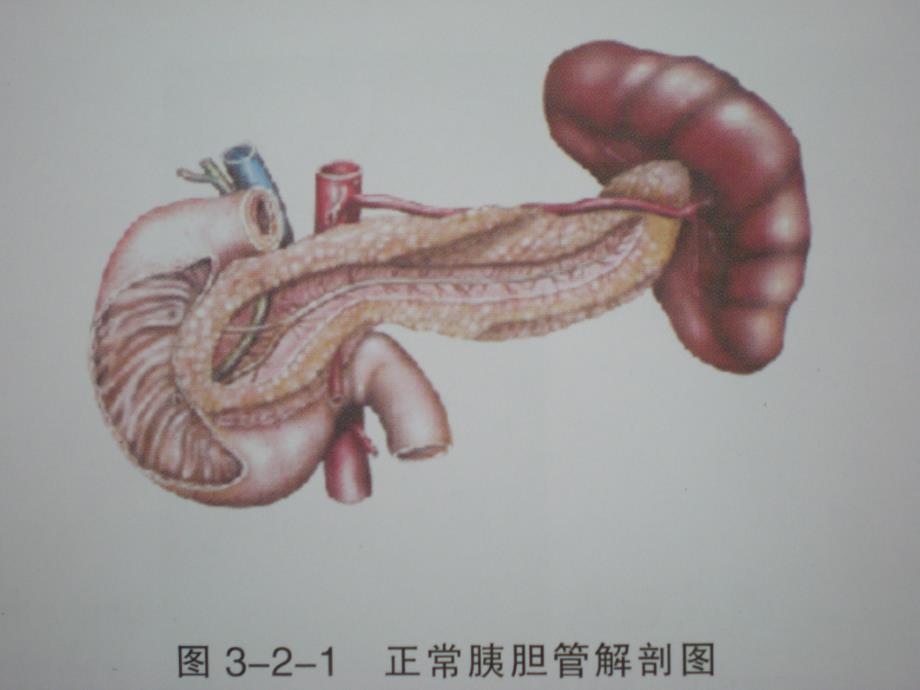 磁共振胰胆管成像_第2页