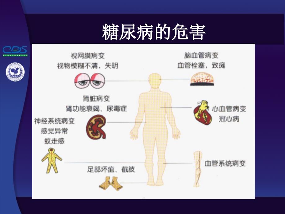 糖尿病高危人群筛查及三级预防_第3页