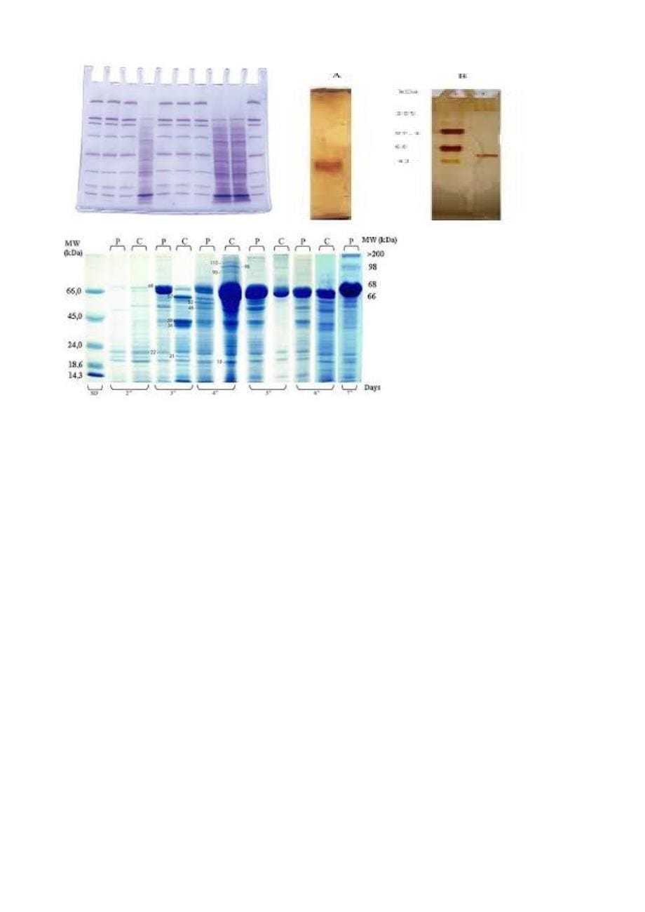 蛋白 sds-page纯度鉴定与分子量测定_第5页