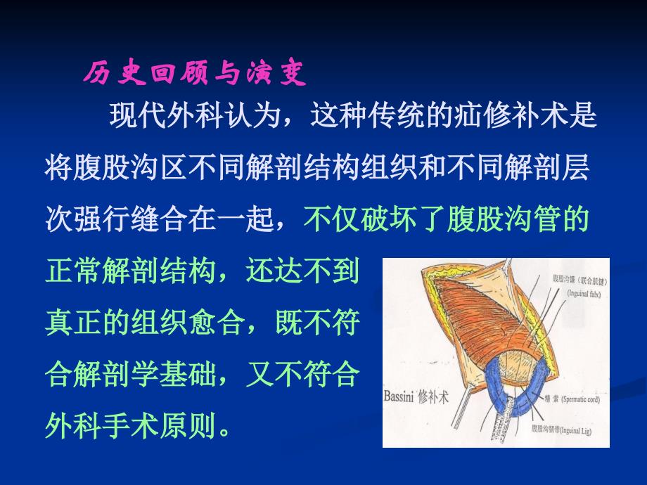 腹股沟疝无张力修补术_第3页