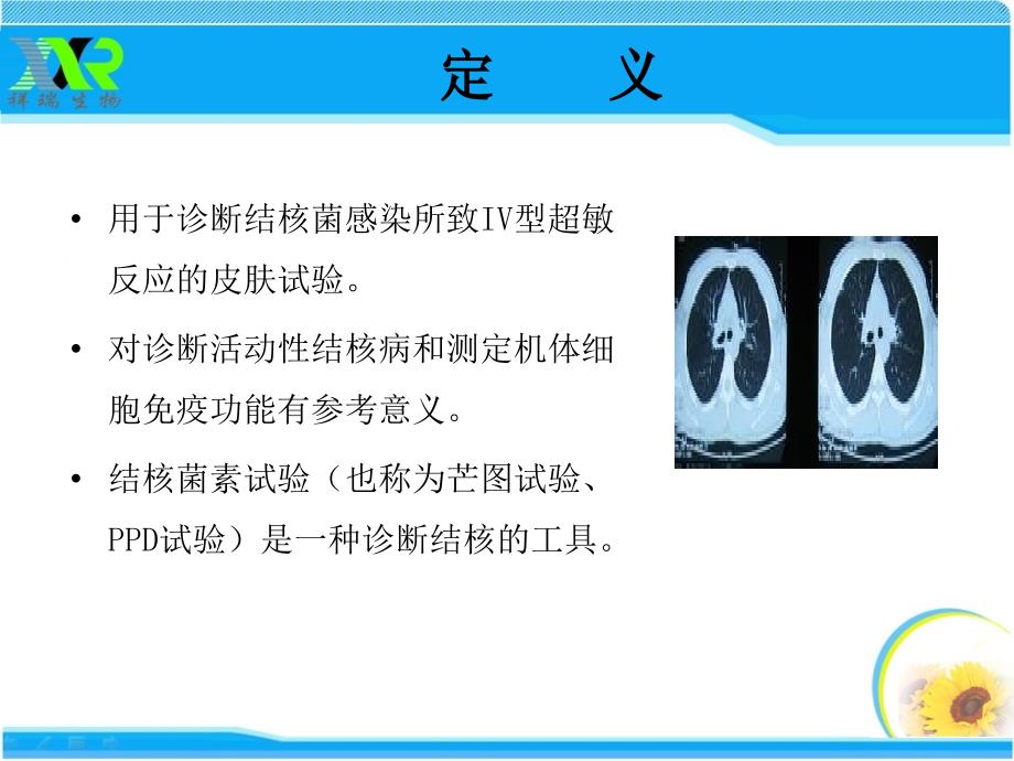 结核菌素PPD培训资料_第2页