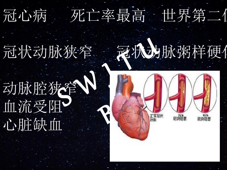 心血管支架的研究与进展_第2页