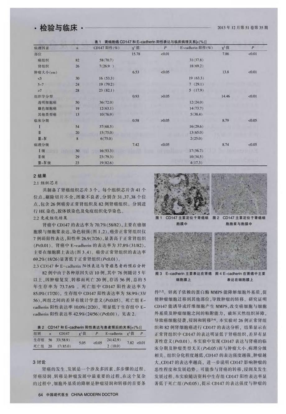 CD147、E-cadherin在肾细胞癌中的表达及意义_第2页