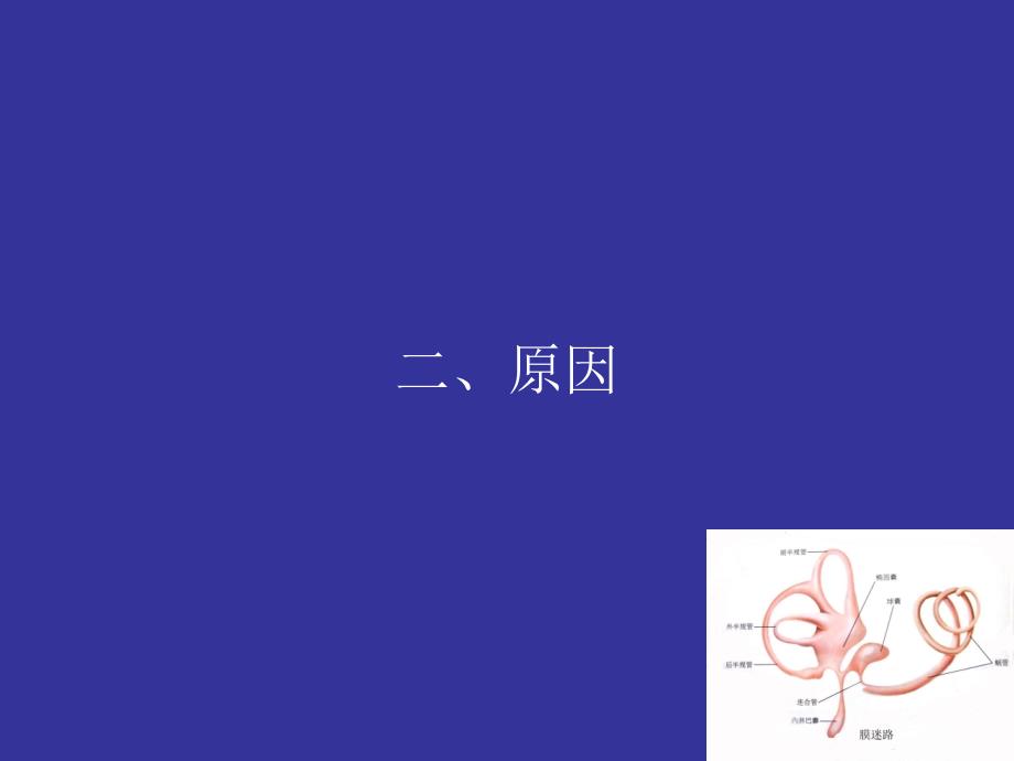 爱爱医资源-膜迷路积水的诊断_第4页