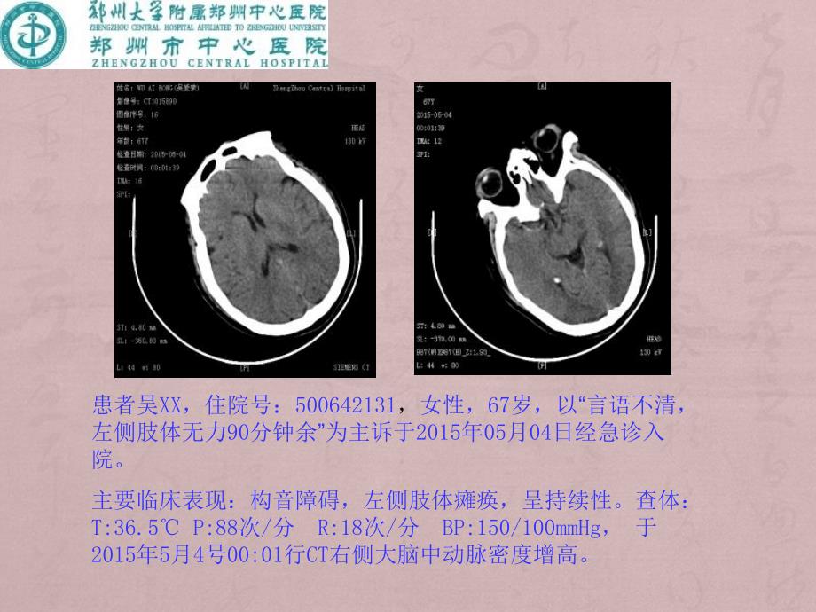 神经系统CTMRI31_第2页