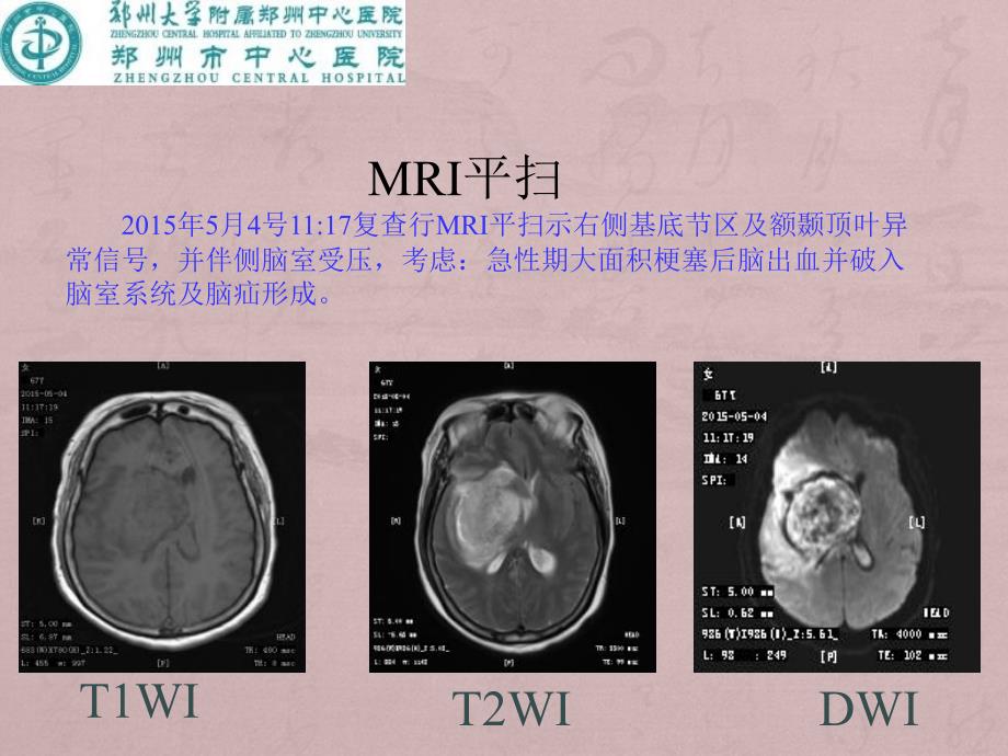 神经系统CTMRI31_第3页