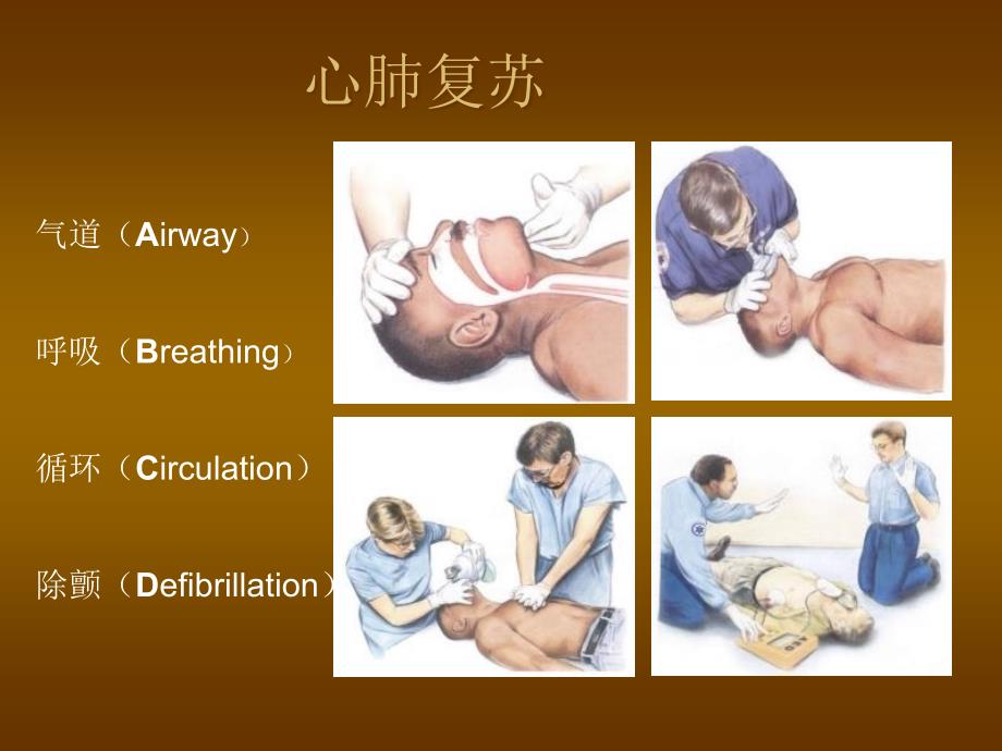 2010年美国AHA心肺复苏指南解读_第2页