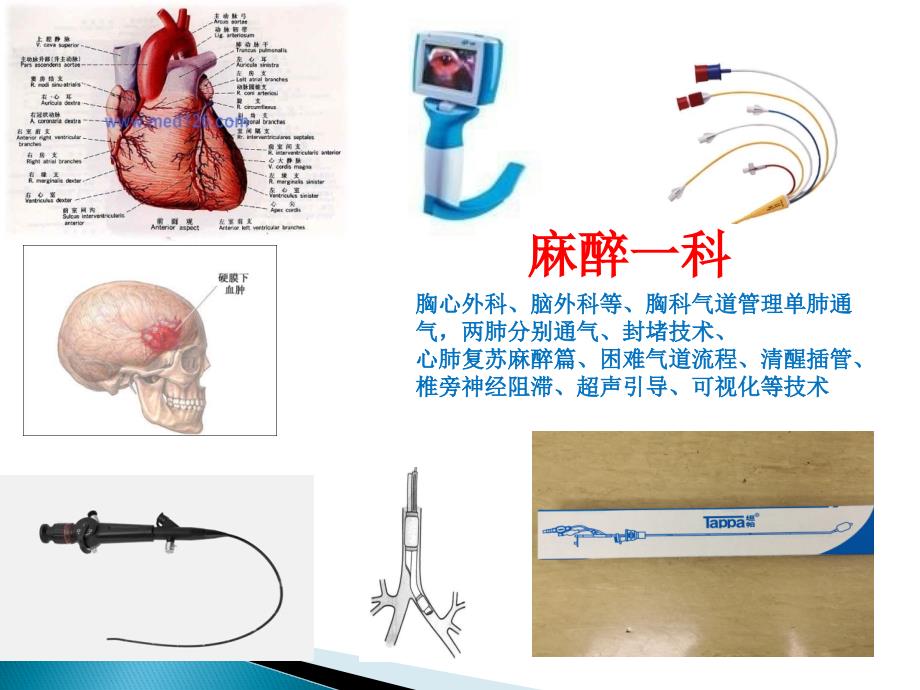 支气管封堵器的插入与定位左肺封堵裴焕爽_第2页