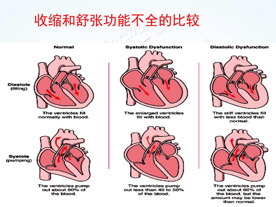 李运德心力衰竭_第3页