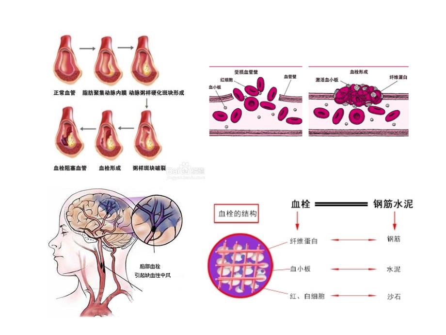 血栓形成及溶栓基本知识大略复习_第2页