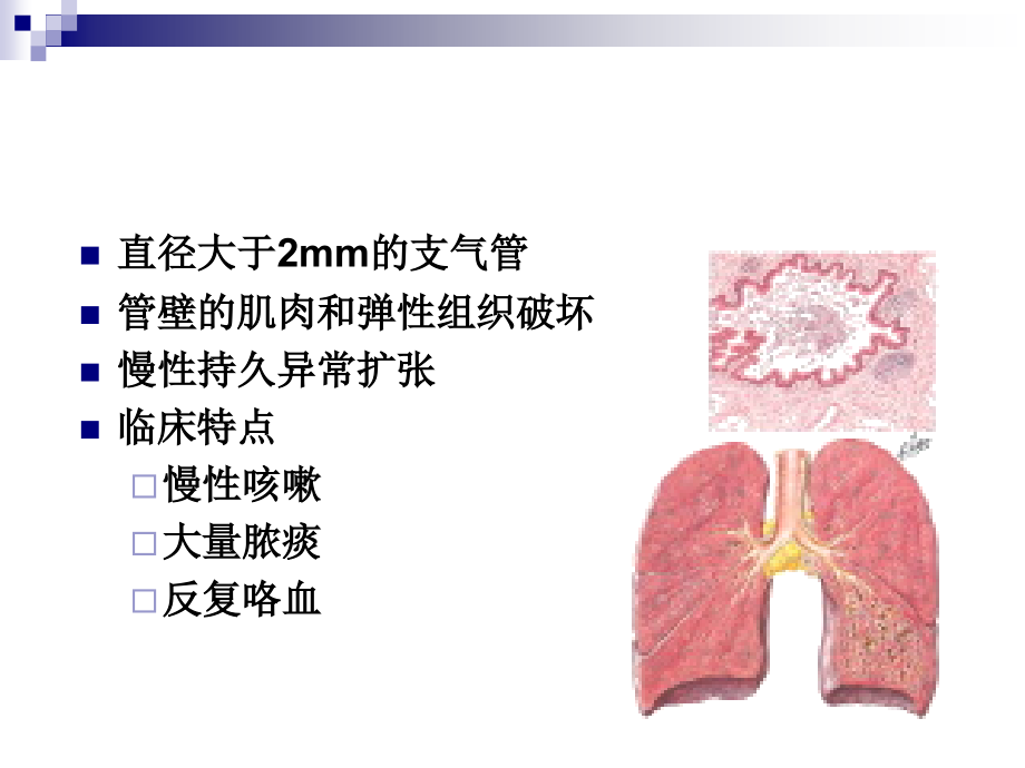 支气管扩张与肺脓肿_第4页