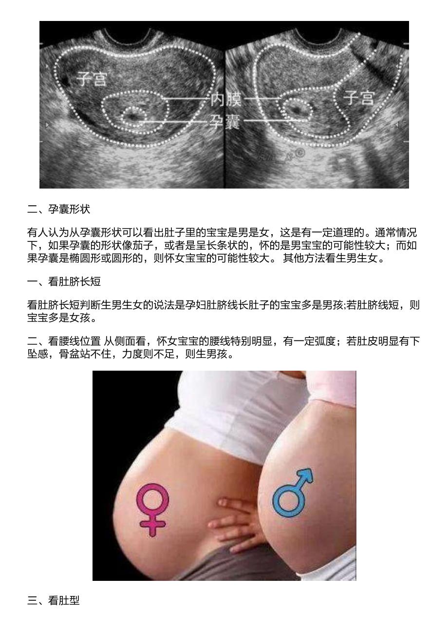 专家教授公开B超辨男女方法 生男生女早知道_第2页