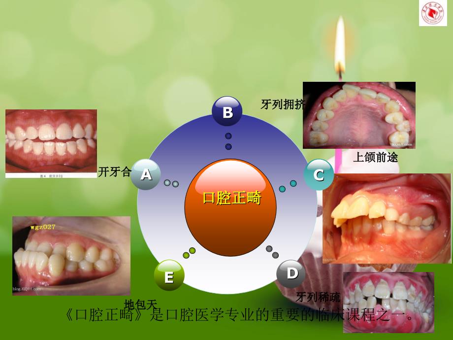 口腔正畸说课ke_第4页