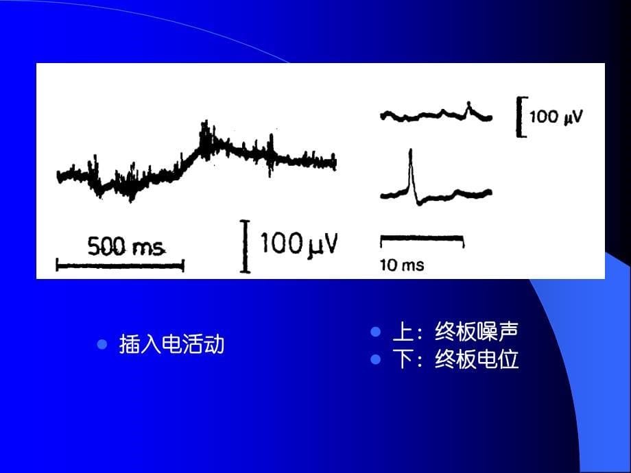 医学电生理学M_第5页