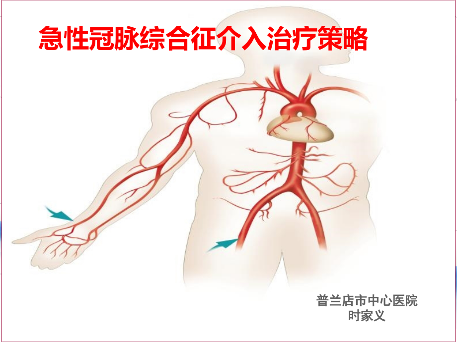 时家义急性冠脉综合征介入治疗策略_第1页