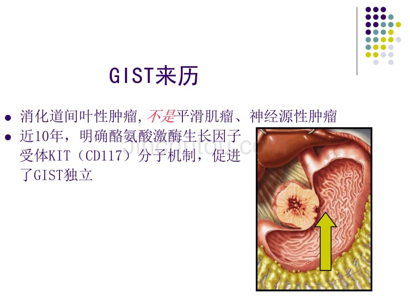 胃肠间质瘤(GIST)_第3页