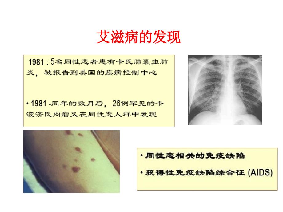 艾滋病及性传播疾病课件_第4页