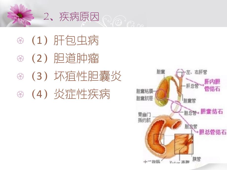 胆瘘的观察及护理_第4页