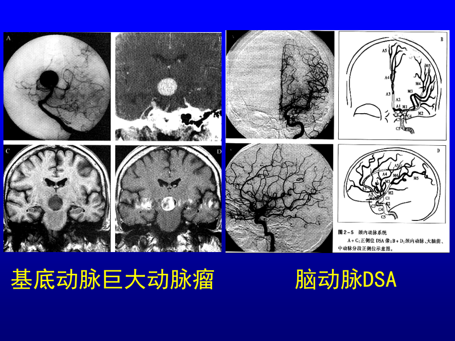 断层解剖总论应用解剖_第5页