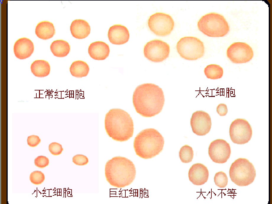 血细胞分析仪的检测技术及临床应用_第3页