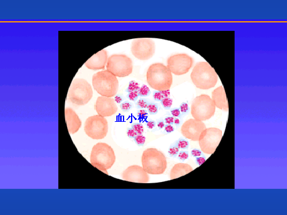血细胞分析仪的检测技术及临床应用_第4页