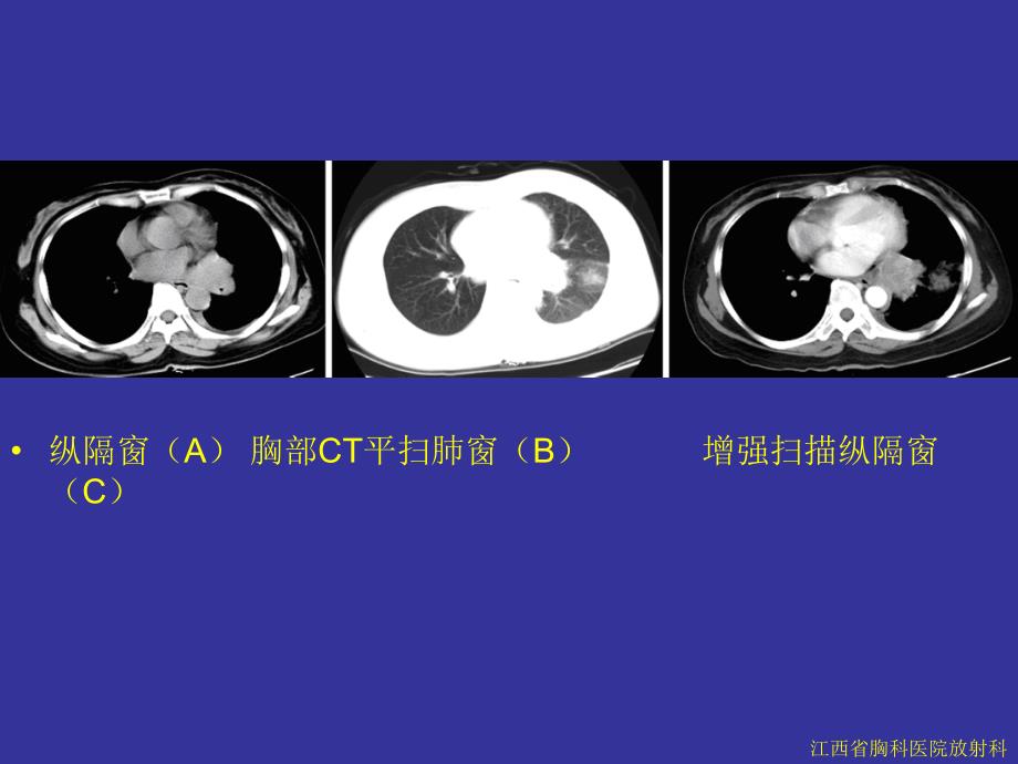 呼吸系统病例_第2页