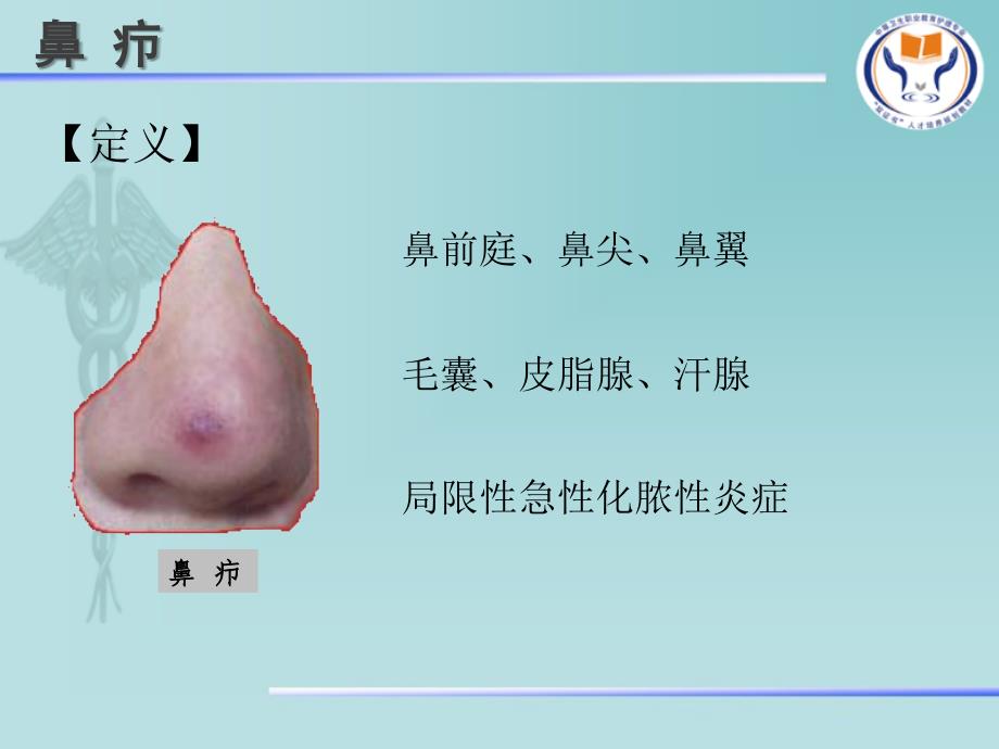 鼻部常见疾病病人的护理1_第2页