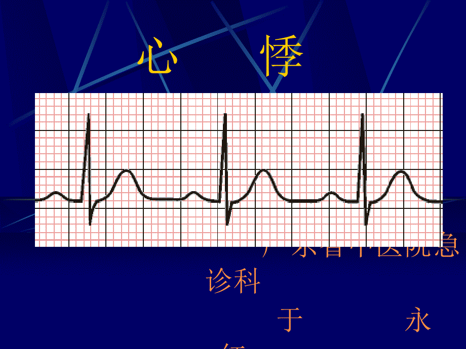 新建中医急诊学心悸教案_第1页