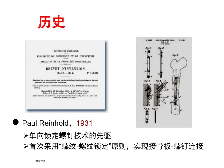 再议锁定接骨板并发症与原因分析_第4页