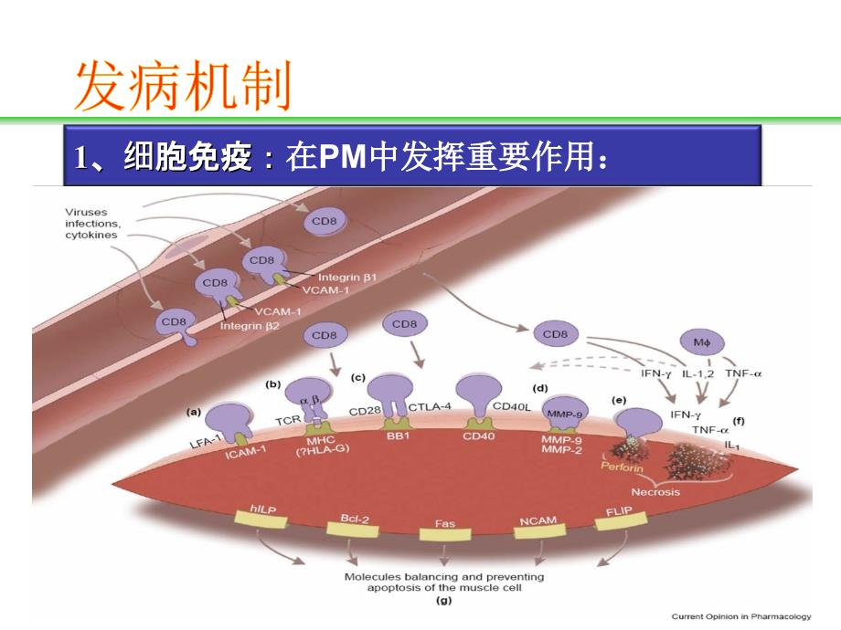 特发性炎性肌病的诊治_第4页