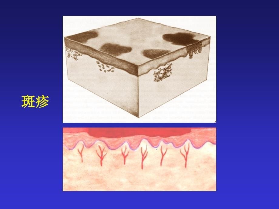 皮肤病的症状授课讲义_第5页