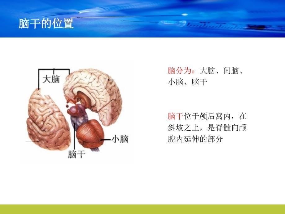 脑干梗塞病人的护理查房2015_第5页