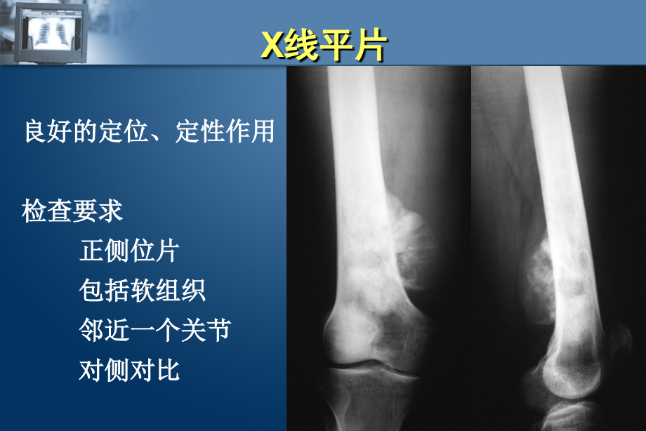 骨关节系统影像学_第4页