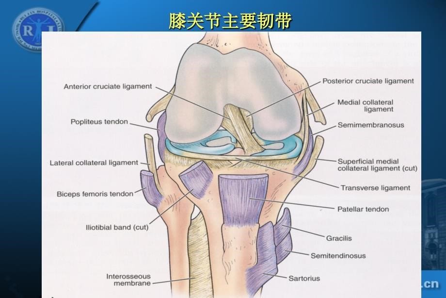 膝关节韧带损伤的MR诊断dxy_第5页
