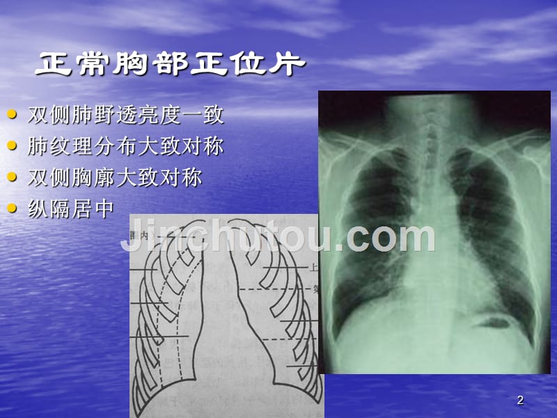 2015临床执业医师实践技能考试影像学(X线、CT、B超)精讲_第2页