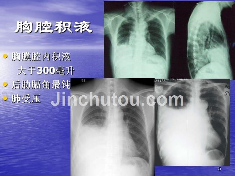 2015临床执业医师实践技能考试影像学(X线、CT、B超)精讲_第5页