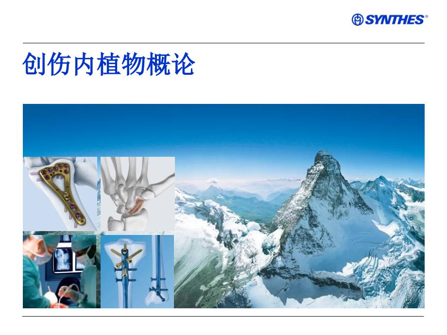 骨科内植物_第1页