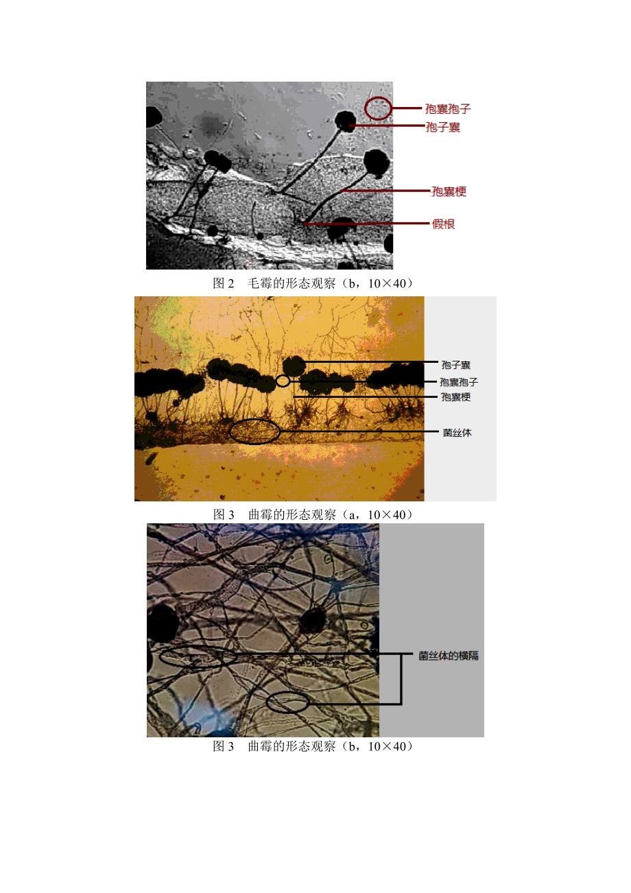 霉菌的观察_第4页