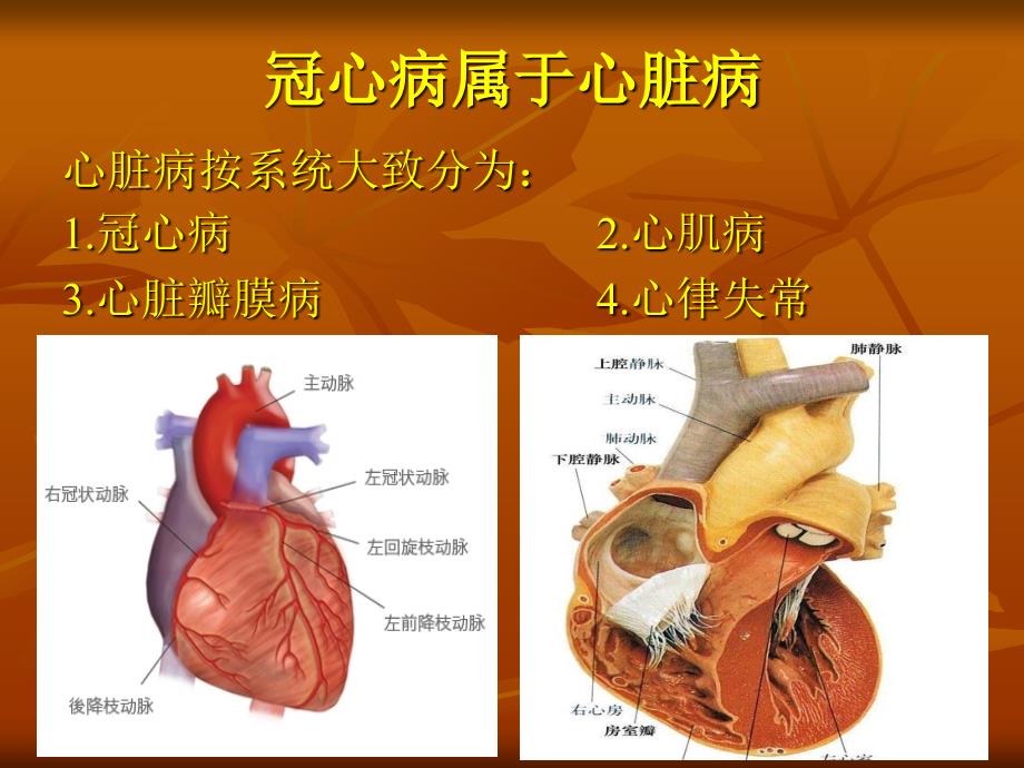 冠心病与猝死_第2页