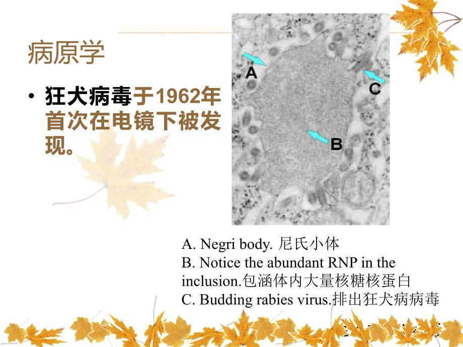 狂犬病暴露后的处置_第4页