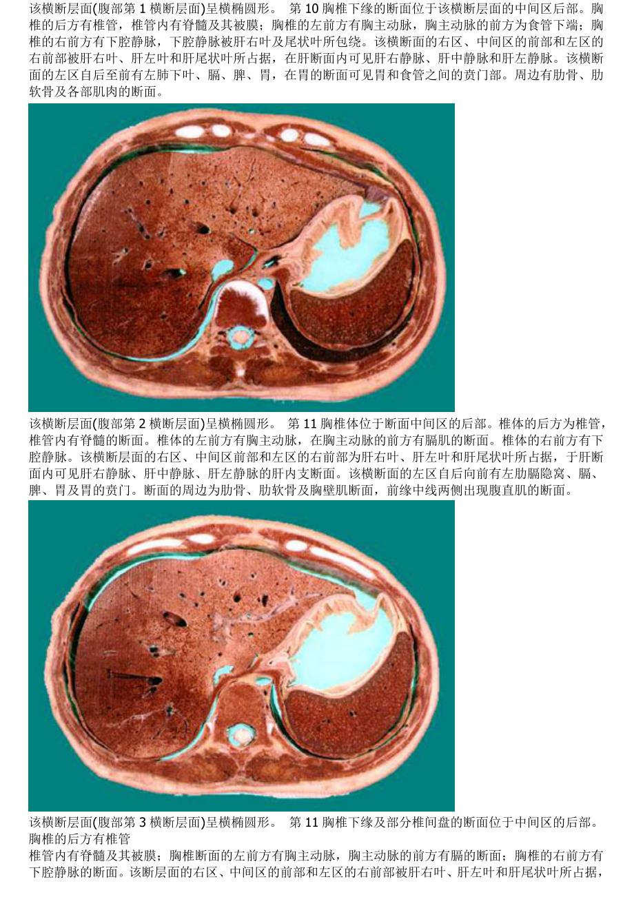 腹部断层解剖彩图_第1页