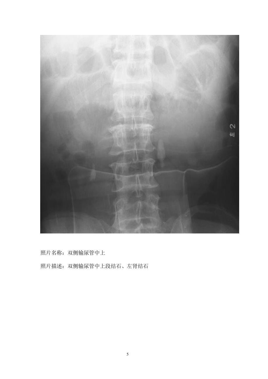 临床x线片病案_第5页