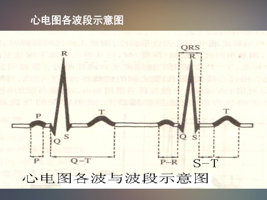 执业医师技能考试辅导心电图_第2页