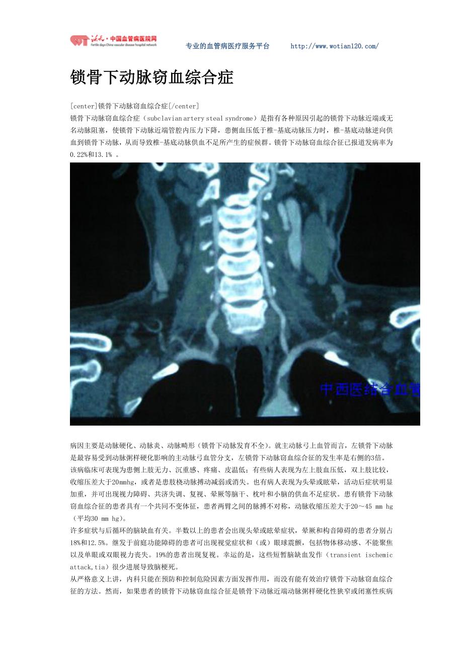 锁骨下动脉窃血综合症全程介绍_第1页